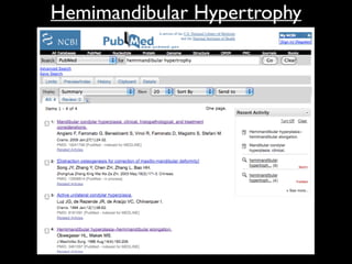 Hemimandibular Hypertrophy
 
