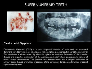 Cleidocranial Dysplasia (CCD) is a rare congenital disorder of bone with an autosomal
dominant hereditary mode of inheritance. with complete penetrance, but variable expressivity.
This condition is characterized by clavicular aplasia or deﬁcient formation of the clavicles,
delayed and imperfect ossiﬁcation of the cranium, moderately short stature, and a variety of
other skeletal abnormalities. The principal oral manifestations are a delayed exfoliation of
primary teeth, delayed or multiple impactions of the permanent dentition, and multiple impacted
supernumerary teeth
SUPERNUMERARY TEETH
Cleidocranial Dysplasia
 