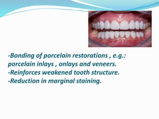-Bonding of porcelain restorations , e.g.:
porcelain inlays , onlays and veneers.
-Reinforces weakened tooth structure.
-Reduction in marginal staining.
 