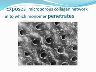 Exposes microporous collagen network
in to which monomer penetrates
 