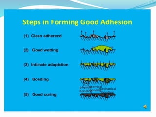 The evolution of adhesivr technique