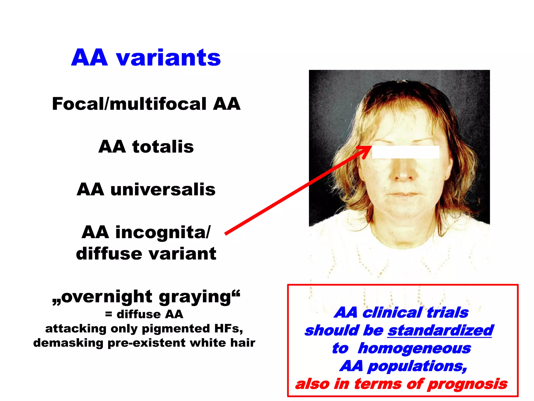 The evolving pathogenesis of alopecia areata and biomarkers of disease ...