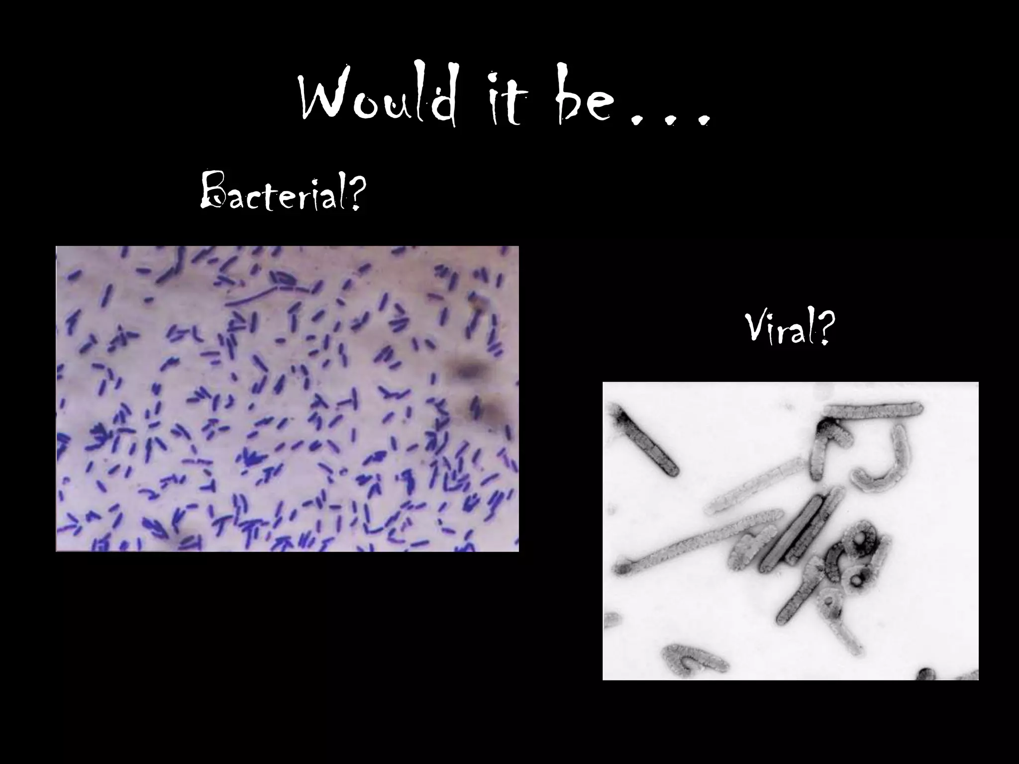 Would it be…
Bacterial?

                    Viral?
 