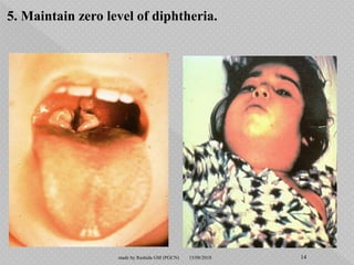 5. Maintain zero level of diphtheria.
15/08/2018 14made by Rashida GM (PGCN)
 
