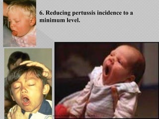 6. Reducing pertussis incidence to a
minimum level.
15/08/2018 15made by Rashida GM (PGCN)
 