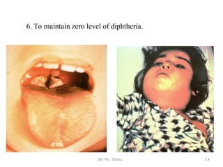6. To maintain zero level of diphtheria.
By Mr. Teklu . 14
 