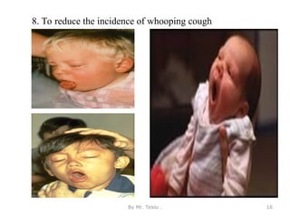 8. To reduce the incidence of whooping cough
By Mr. Teklu . 16
 