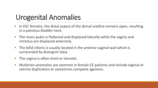 The exstrophy epispadias complex | PDF