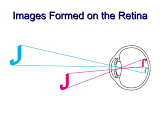 Images Formed on the Retina
 