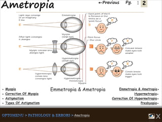 2←Previous Pg. 1
Emmetropia & Ametropia●● Myopia
Hypermetropia●● Correction Of Myopia
Correction Of Hypermetropia●● Astigmatism
Presbyopia●● Types Of Astigmatism
Emmetropia & Ametropia
 