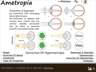 2←Previous Pg. 1
Correction of hyperopia
(a) Correction with converging
lenses (plus lenses).
(b) Correction of aphakia with
cataract lens, contact lens (c),
anterior chamber intraocular
lens (d, blue) or posterior
chamber intraocular lens(d, red).
Emmetropia & Ametropia●● Myopia
Hypermetropia●● Correction Of Myopia
Correction Of Hypermetropia●● Astigmatism
Presbyopia●● Types Of Astigmatism
Correction Of Hypermetropia
 