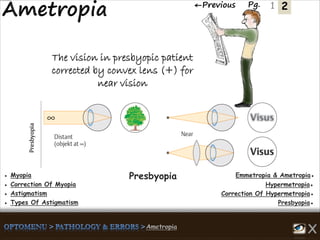 2←Previous Pg. 1
The vision in presbyopic patient
corrected by convex lens (+) for
near vision
Emmetropia & Ametropia●● Myopia
Hypermetropia●● Correction Of Myopia
Correction Of Hypermetropia●● Astigmatism
Presbyopia●● Types Of Astigmatism
Presbyopia
 