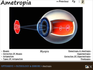 2←Previous Pg. 1
Emmetropia & Ametropia●● Myopia
Hypermetropia●● Correction Of Myopia
Correction Of Hypermetropia●● Astigmatism
Presbyopia●● Types Of Astigmatism
Myopia
 