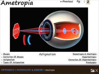 2←Previous Pg. 1
Emmetropia & Ametropia●● Myopia
Hypermetropia●● Correction Of Myopia
Correction Of Hypermetropia●● Astigmatism
Presbyopia●● Types Of Astigmatism
Astigmatism
 