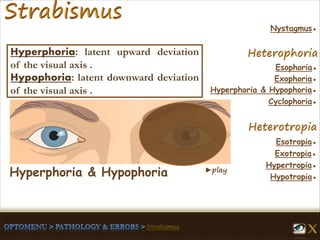 ►play
Esophoria●
Esotropia●
Hypertropia●
Exotropia●
Hypotropia●
Exophoria●
Hyperphoria & Hypophoria●
Cyclophoria●
Nystagmus●
Hyperphoria & Hypophoria
Hyperphoria: latent upward deviation
of the visual axis .
Hypophoria: latent downward deviation
of the visual axis .
 