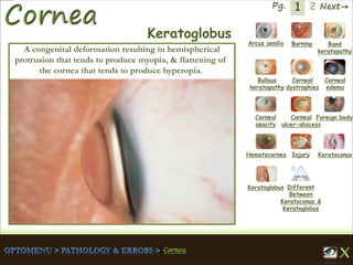 1 Next→Pg. 2
Arcus senilis Burning Band
keratopathy
Bullous
keratopathy
Corneal
dystrophies
Corneal
edema
Corneal
opacity
Corneal
ulcer-abscess
Foreign body
Hematocornea Injury Keratoconus
Keratoglobus Different
Between
Keratoconus &
Keratoglobus
Keratoglobus
A congenital deformation resulting in hemispherical
protrusion that tends to produce myopia, & flattening of
the cornea that tends to produce hyperopia.
 