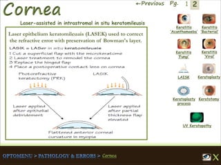 2←Previous Pg. 1
Keratitis
‘Acanthamoeba’
Keratitis
‘Bacterial’
Keratitis
‘Fungi’
Keratitis
‘Viral’
Keratoplasty
process
LAISK Keratoplasty
Keratotomy
UV Keratopathy
Laser-assisted in intrastromal in situ keratomileusis
Laser epithelium keratomileuais (LASEK) used to correct
the refractive error with preservation of Bowman's layer.
 