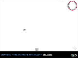 1Pg. 2
The Sclera
The whitish opaque outer coat of the eye which form 5/6 of the outer
layer of the eye
formed by the sclera .
All six ocular muscles insert into the sclera .
The sclera is thickest (1mm) anteriorly at the limbus & thinnest
(0.3mm) beneath the insertions of the rectus muscles .
It joins with the :
* Cornea at the limbus ,
* Optic nerve enter the sclera at lamina cribrosa ,
* The angle of the anterior chamber , to form the trabecular network
and the canal of Schlemm .
XThe Sclera
←Back
 