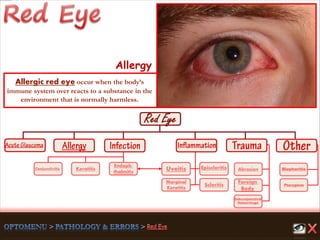 Endoph-
thalmitis
Keratitis
Scleritis
Marginal
Keratitis
Uveitis
Foreign
Body
Abrasion
Pterygium
Conjunctivitis
Subconjunctival
Hemorrhage
Episcleritis Blepharitis
Allergy
Allergic red eye occur when the body’s
immune system over reacts to a substance in the
environment that is normally harmless.
 