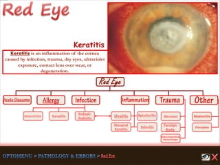 Endoph-
thalmitis
Keratitis
Scleritis
Marginal
Keratitis
Uveitis
Foreign
Body
Abrasion
Pterygium
Conjunctivitis
Subconjunctival
Hemorrhage
Episcleritis Blepharitis
Keratitis
Keratitis is an inflammation of the cornea
caused by infection, trauma, dry eyes, ultraviolet
exposure, contact lens over wear, or
degeneration.
 