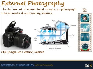 Is the use of a conventional camera to photograph
external ocular & surrounding features .
SLR (Single lens Reflex) Camera
press
 