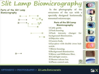 Parts of the Slit Lamp
Biomicrography
1.Cable guide.
2.Flash housing.
3.Flash intensity changer for
background illumination.
4.Objective tube.
5.Camera body.
6.Eye-piece with double cross hair
reticle.
7.Mirror housing.
8.Background illumination.
9.Mirror and Diffusion filter.
10.Cold light source.
11.Shutter release bar.
12.Photo control unit.
Parts of the Slit Lamp
Biomicrography
Is the photography of the
structures of the eye with a
specially designed horizontally
mounted microscope.
press
1
23
4
5
6
7
8
9
10
12
11
 