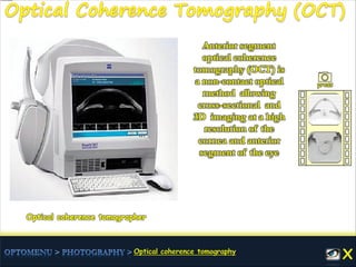 Optical coherence tomographer
Anterior segment
optical coherence
tomography (OCT) is
a non-contact optical
method allowing
cross-sectional and
3D imaging at a high
resolution of the
cornea and anterior
segment of the eye
press
 