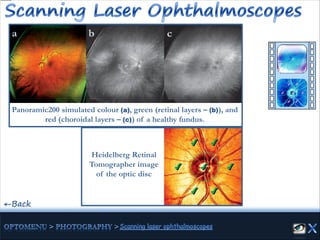 Panoramic200 simulated colour (a), green (retinal layers – (b)), and
red (choroidal layers – (c)) of a healthy fundus.
←Back
a cb
Heidelberg Retinal
Tomographer image
of the optic disc
 