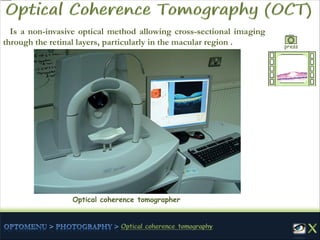 Is a non-invasive optical method allowing cross-sectional imaging
through the retinal layers, particularly in the macular region .
Optical coherence tomographer
press
 