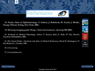 Copyright: Asmaa Jamal, 2011
12- Pocket Atlas of Ophthalmology: T. Schlote, J. Rohrbach, M. Grueb, J. Mielke,
George Thieme Verlag, New York, 2006 .
13- Slit lamp imaging guide: Haag – Streit International , slit lamp BX 900® .
14- Textbook of Medical Physiology: Arthur C. Guyton, John E. Hall, 11th Ed, Elsevier
Saunders, Philadelphia, 2006 .
15- The Visual Fields a Textbook and Atlas of Clinical Perimetery: David O. Harrington, 5th
Ed, Mosby Co. , London, 1981 .
16- www.aao.org
17- www.eyeatlas.com
No
Image
Pg. 1 2 3
 