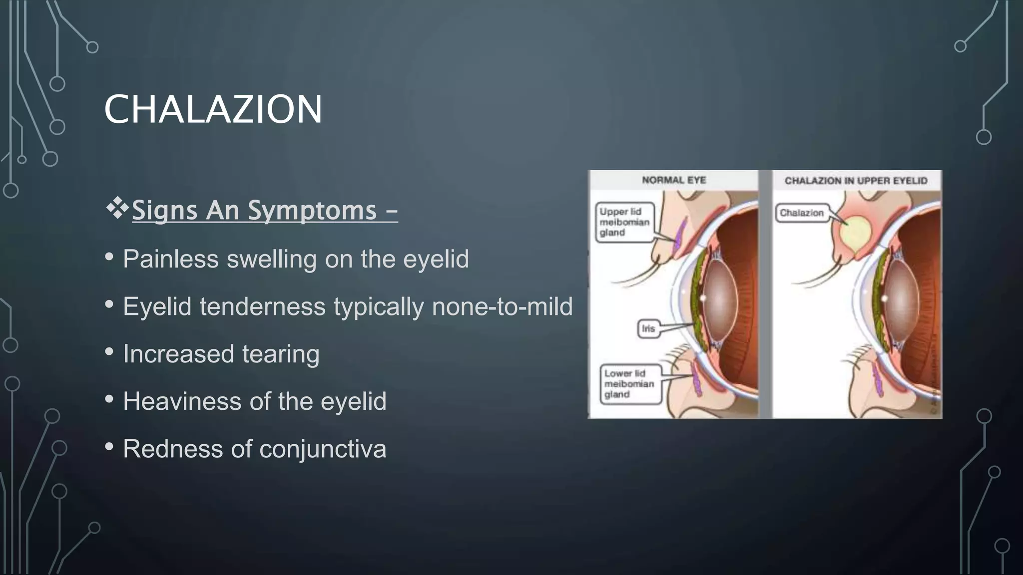 Eyelids And Its Abnormalities PPTX eyelids-and-its-abnormalities-pptx
