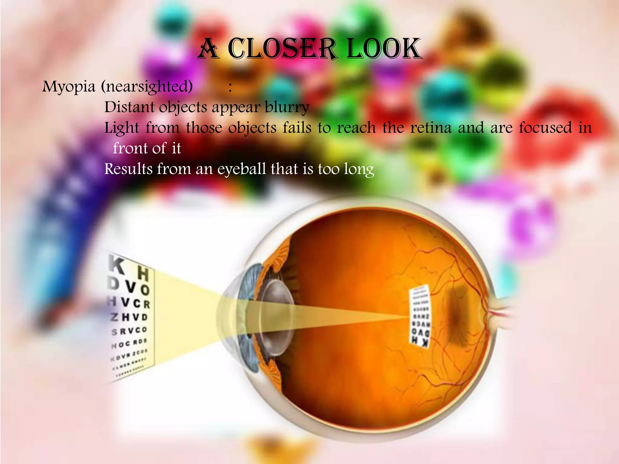 A CLOSER LOOK
Myopia (nearsighted)      :
        Distant objects appear blurry
        Light from those objects fails to reach the retina and are focused in
         front of it
        Results from an eyeball that is too long
 