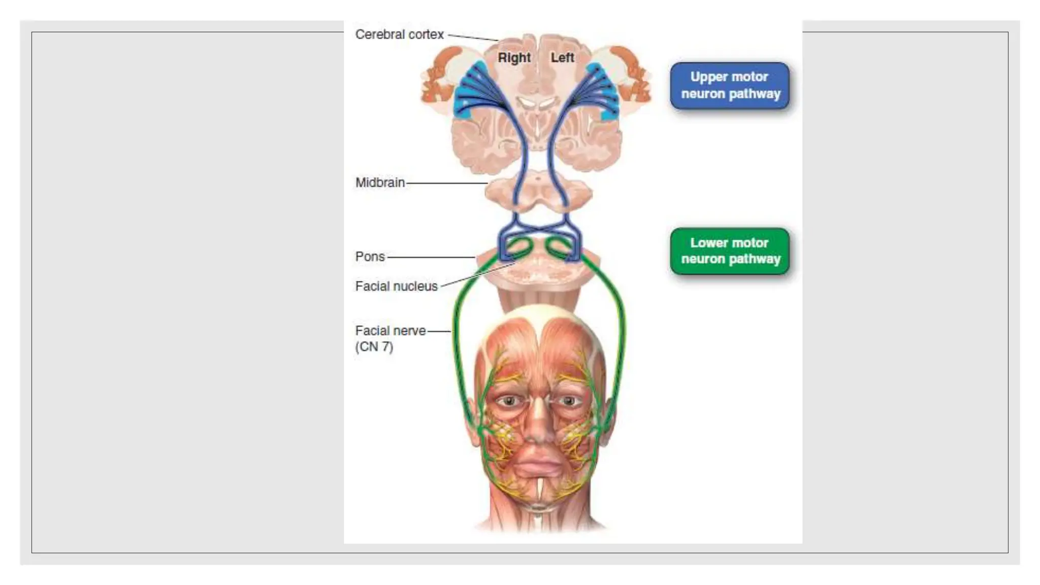 The facial nerve- anatomy and clinical examination | PPTX