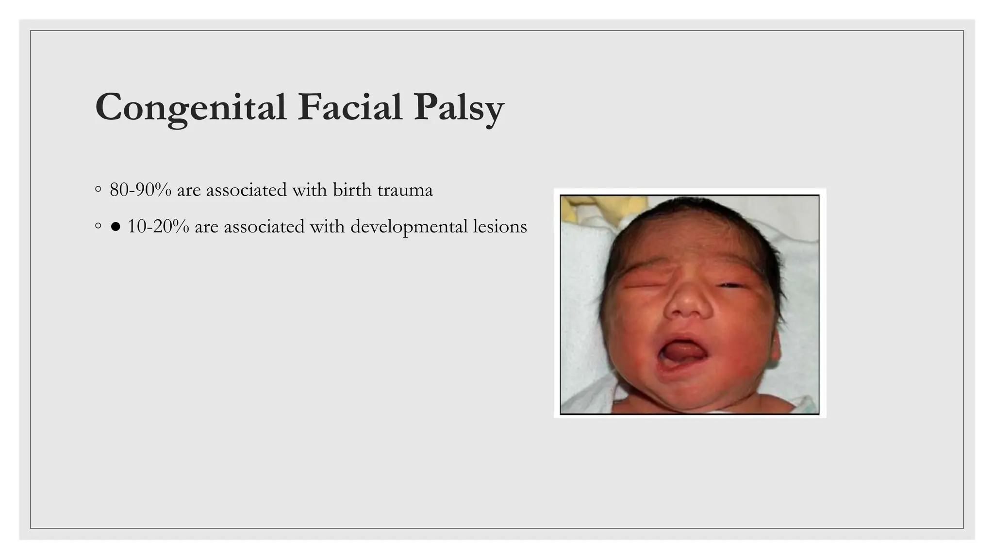 The facial nerve- anatomy and clinical examination | PPTX