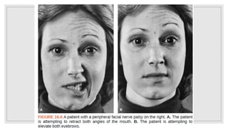 The facial nerve- anatomy and clinical examination | PPTX