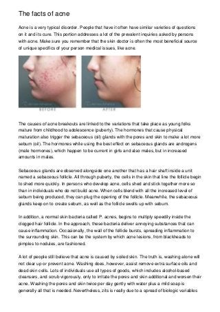 The facts of acne
Acne is a very typical disorder. People that have it often have similar varieties of questions
on it and its cure. This portion addresses a lot of the prevalent inquiries asked by persons
with acne. Make sure you remember that the skin doctor is often the most beneficial source
of unique specifics of your person medical issues, like acne.

The causes of acne breakouts are linked to the variations that take place as young folks
mature from childhood to adolescence (puberty). The hormones that cause physical
maturation also trigger the sebaceous (oil) glands with the pores and skin to make a lot more
sebum (oil). The hormones while using the best effect on sebaceous glands are androgens
(male hormones), which happen to be current in girls and also males, but in increased
amounts in males.
Sebaceous glands are observed alongside one another that has a hair shaft inside a unit
named a sebaceous follicle. All through puberty, the cells in the skin that line the follicle begin
to shed more quickly. In persons who develop acne, cells shed and stick together more so
than in individuals who do not build acne. When cells blend with all the increased level of
sebum being produced, they can plug the opening of the follicle. Meanwhile, the sebaceous
glands keep on to create sebum, as well as the follicle swells up with sebum.
In addition, a normal skin bacteria called P. acnes, begins to multiply speedily inside the
clogged hair follicle. In the approach, these bacteria deliver annoying substances that can
cause inflammation. Occasionally, the wall of the follicle bursts, spreading inflammation to
the surrounding skin. This can be the system by which acne lesions, from blackheads to
pimples to nodules, are fashioned.
A lot of people still believe that acne is caused by soiled skin. The truth is, washing alone will
not clear up or prevent acne. Washing does, however, assist remove extra surface oils and
dead skin cells. Lots of individuals use all types of goods, which includes alcohol-based
cleansers, and scrub vigorously, only to irritate the pores and skin additional and worsen their
acne. Washing the pores and skin twice per day gently with water plus a mild soap is
generally all that is needed. Nevertheless, zits is really due to a spread of biologic variables

 