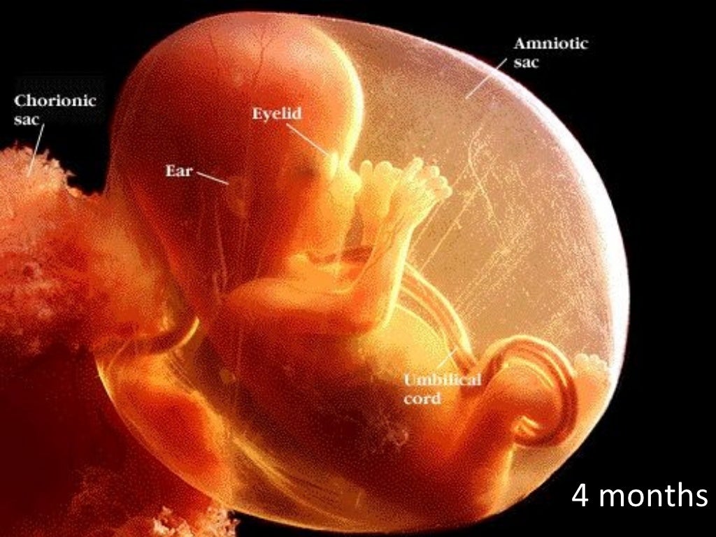 4个月胎儿彩超-图库-五毛网