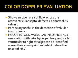  Shows an open area of flow across the
atrioventricular septal defects + abnormal AV
valves .
 Particulary useful in the detection of valvular
insufficiency .
 HOLOSYSTOLICVALVULAR INSUFFICIENCY –
association with fetal hydrops , frequently a left
ventricular to right atrial jet can be identified
across the ostium primum defect before the
onset of HSVI.
 
