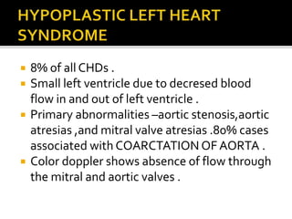  8% of all CHDs .
 Small left ventricle due to decresed blood
flow in and out of left ventricle .
 Primary abnormalities –aortic stenosis,aortic
atresias ,and mitral valve atresias .80% cases
associated with COARCTATION OF AORTA .
 Color doppler shows absence of flow through
the mitral and aortic valves .
 