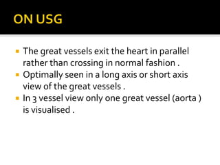 The great vessels exit the heart in parallel
rather than crossing in normal fashion .
 Optimally seen in a long axis or short axis
view of the great vessels .
 In 3 vessel view only one great vessel (aorta )
is visualised .
 