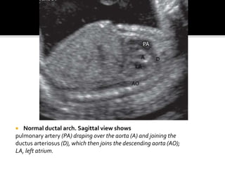 The fetal heart