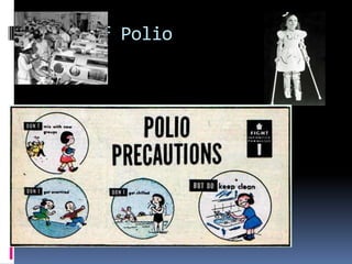 Fear of Polio
 