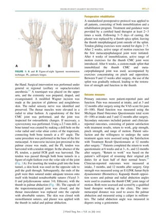 Figure-of-Eight Ligament Reconstruction for Thumb CMC Instability ...