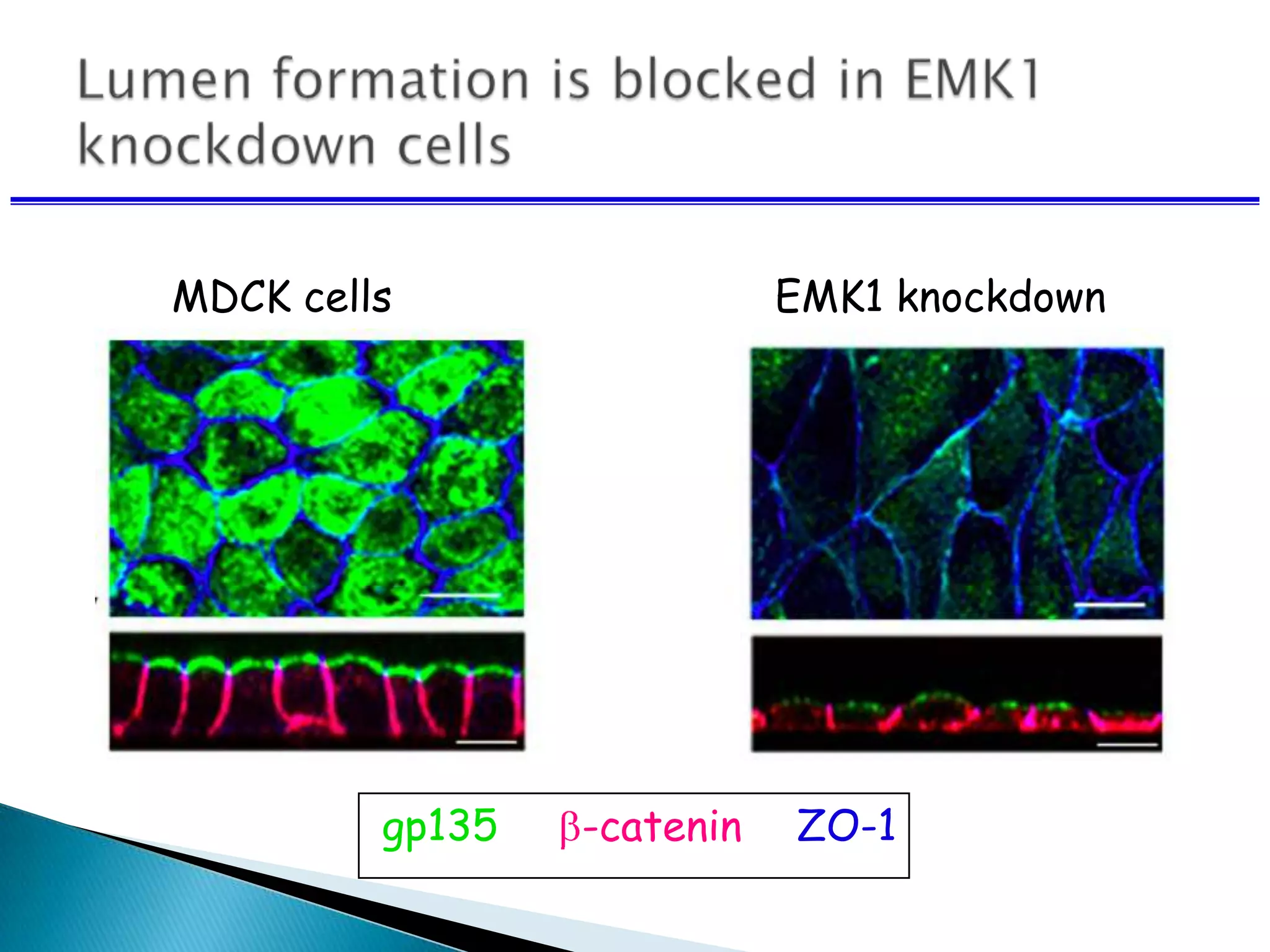 gp135 -catenin ZO-1
MDCK cells EMK1 knockdown
 