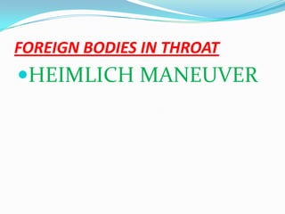 FOREIGN BODIES IN THROAT
HEIMLICH MANEUVER
 