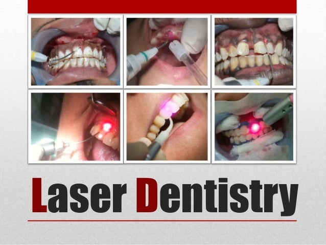 Laser Dentistry for Surgery & Aesthetics Laser Dentistry for Surgery & Aesthetics