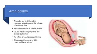 The first stage of labour, poor progression of labour, and augmentation ...