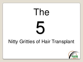 The
5
Nitty Gritties of Hair Transplant
 