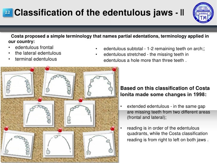 A Classification Of The Edentulous Jaws