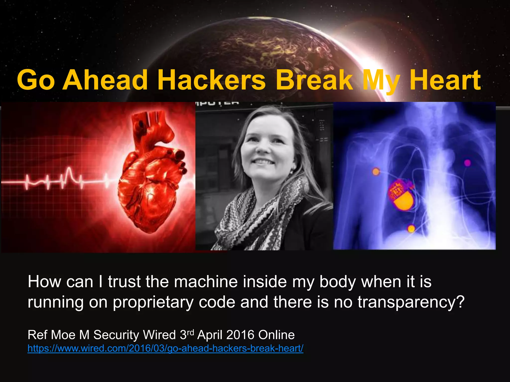Go Ahead Hackers Break My Heart
How can I trust the machine inside my body when it is
running on proprietary code and there is no transparency?
Ref Moe M Security Wired 3rd April 2016 Online
https://www.wired.com/2016/03/go-ahead-hackers-break-heart/
 